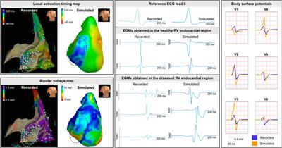 Incorporating structural abnormalities in equivalent dipole layer based ECG simulations